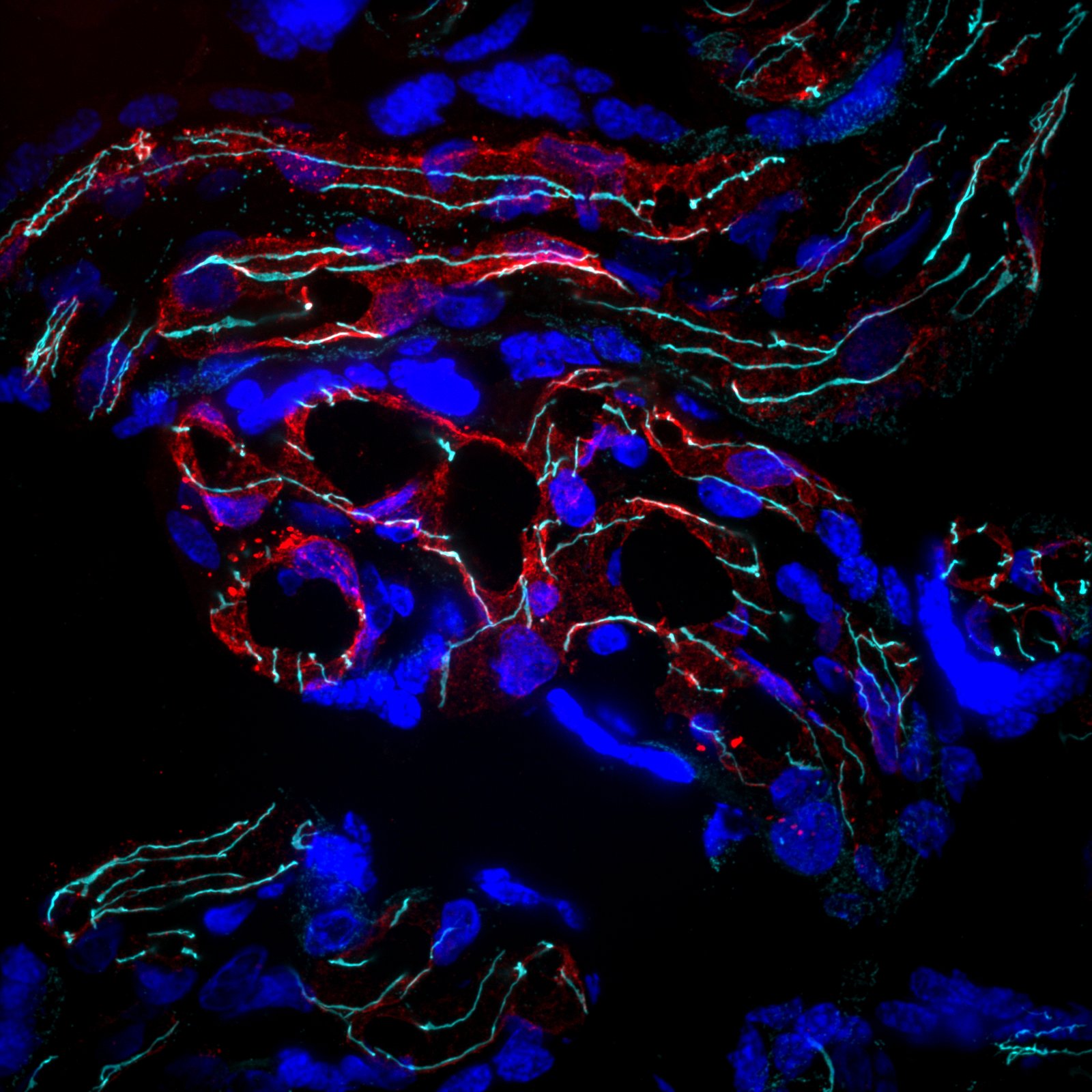 Fluorescence microscopy of IL1RA and blood vessels at the maternal-fetal interface